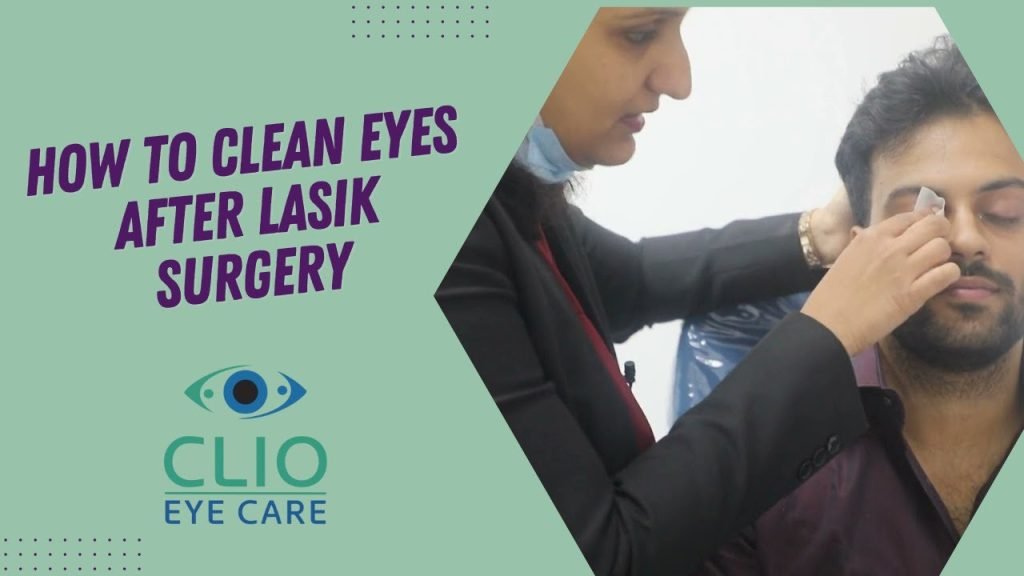 How To Clean Eyelashes After Lasik How To Clean Eyelashes After Lasik