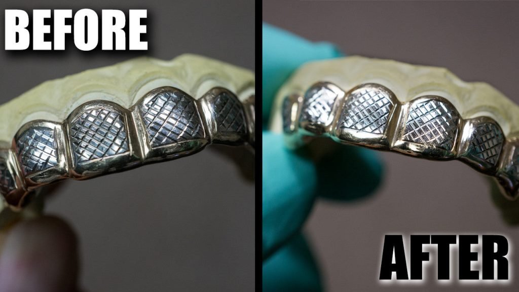 How To Clean Grillz At Home