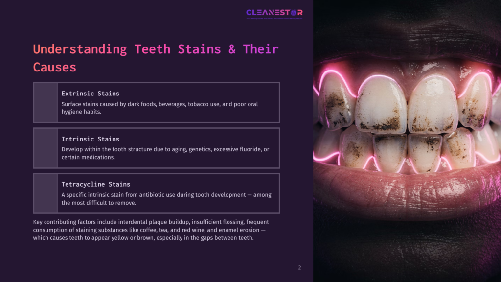 Close-Up Of Stained Teeth With Bright Pink Neon Light Highlighting The Dark Yellow And Brown Stains, Illustrating Tooth Discoloration And Causes.