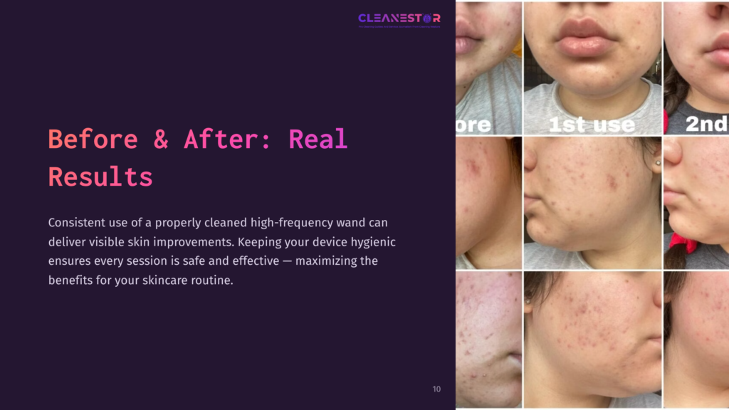 Before And After Collage Showing Close-Up Views Of Skin On Cheeks, Highlighting Improvements In Texture And Clarity Post-Treatment.