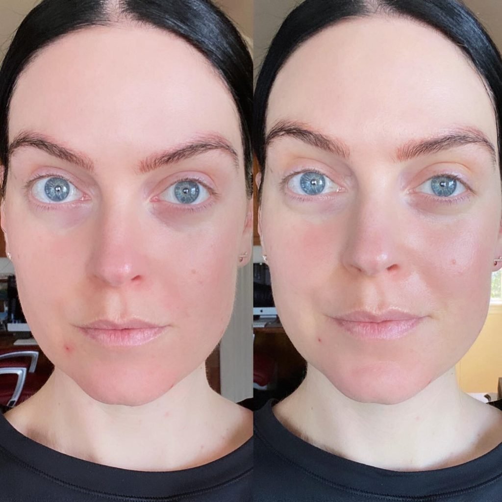 How To Clean Omnilux Led Mask