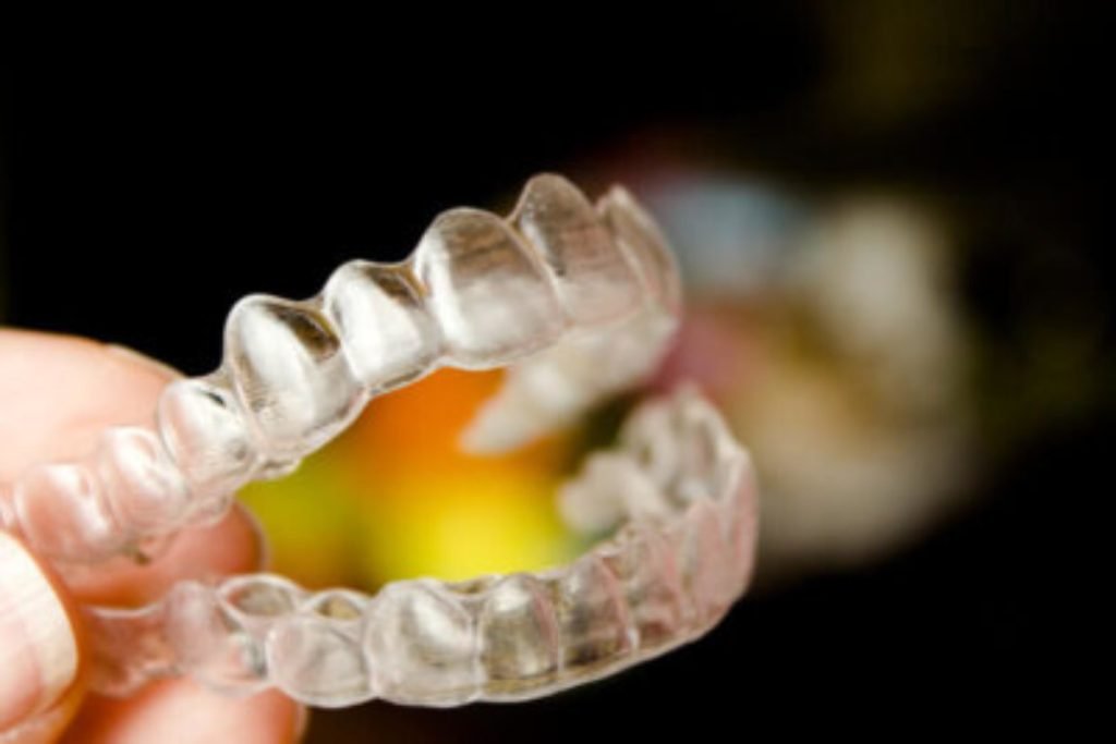 How To Clean Stained Invisalign How To Clean Stained Invisalign