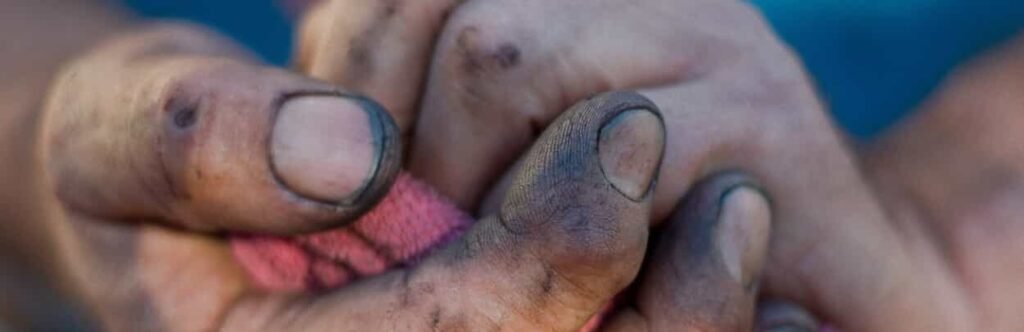 Is Brake Cleaner Bad For Your Skin